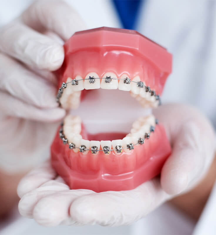 Orthodontic Treatment in Malad West