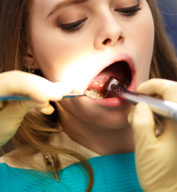 Tooth Extractions Treatment in Malad West