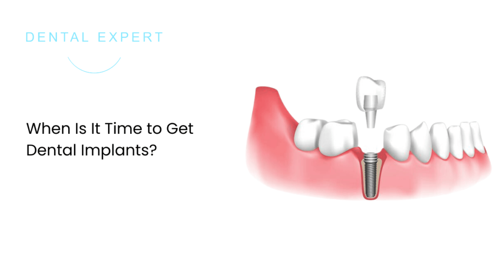 When Is It Time to Get Dental Implants? Dental Expert Clinic