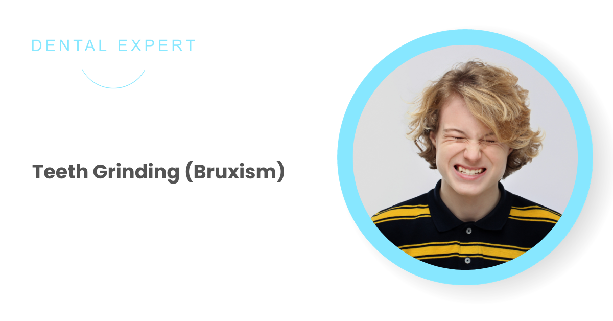 Teeth Grinding (Bruxism): Strategies for Management