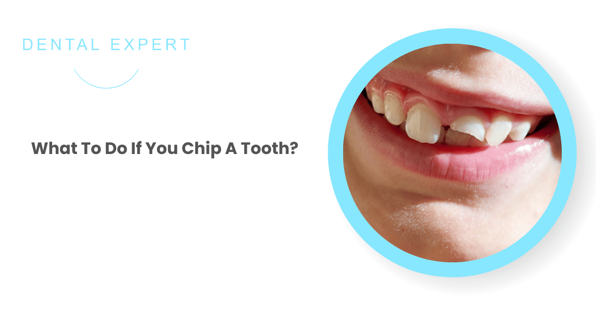 What To Do If You Chip A Tooth