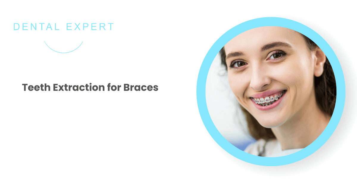 Teeth Extraction for Braces