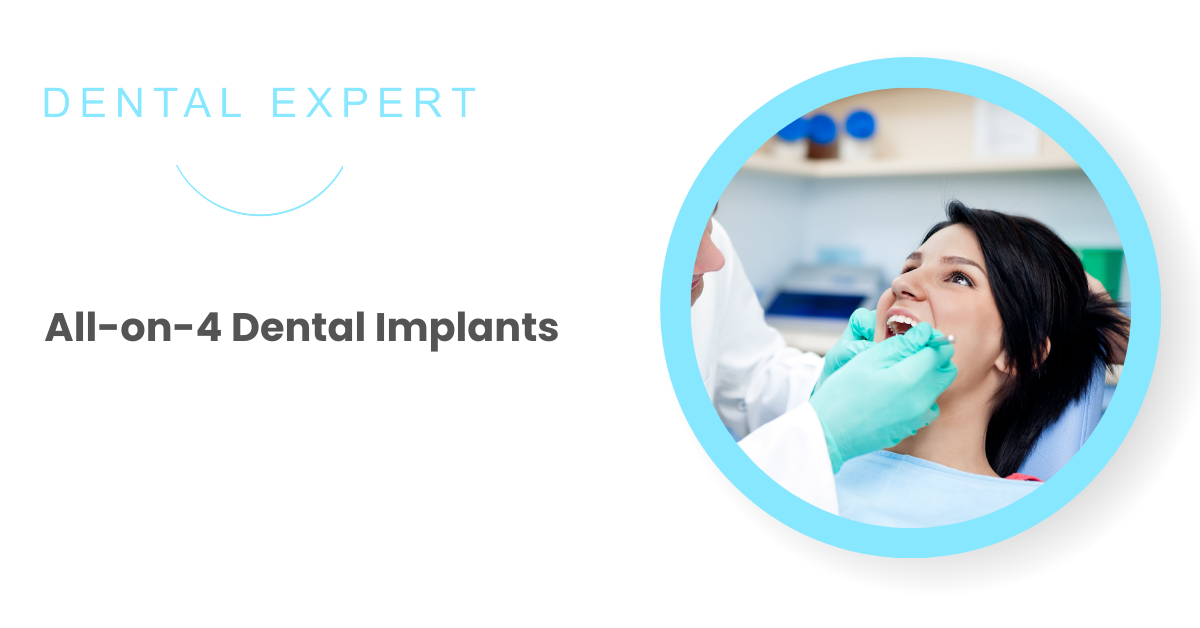 All-on-4 Dental Implants