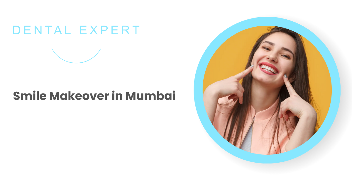 Get a Stunning Smile Makeover in Mumbai: What You Should Know