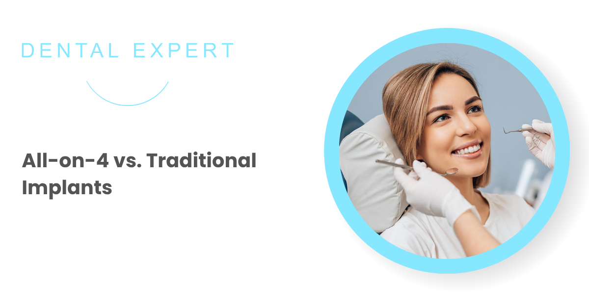 All-on-4 vs. Traditional Implants: Which is Right for You?
