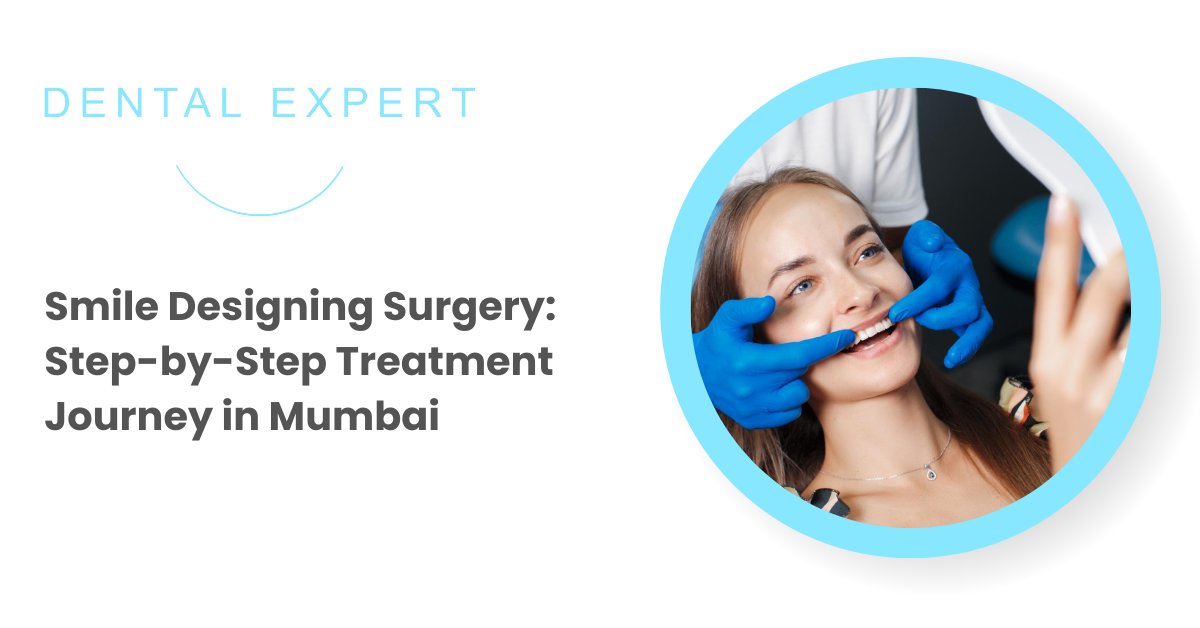 Smile Designing Surgery Treatment
