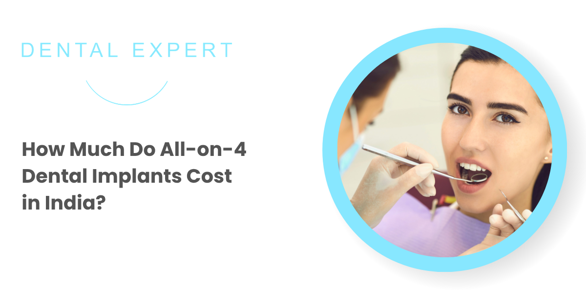 How Much Do All-on-4 Dental Implants Cost in India?