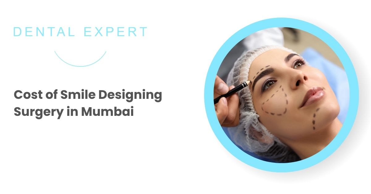Cost of Smile Designing Surgery in Mumbai
