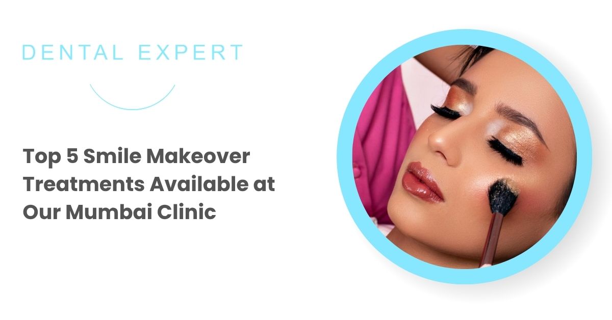 Top 5 smile makeover treatments in Mumbai including veneers, teeth whitening, clear aligners, gum contouring and dental bonding at Dental Expert Clinic.